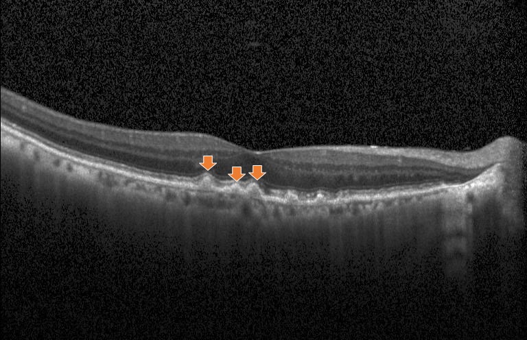 Oct image. Oct image